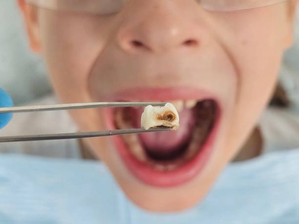 Best Emergency Dental Care for Trauma or Injury in Milltown, NJ